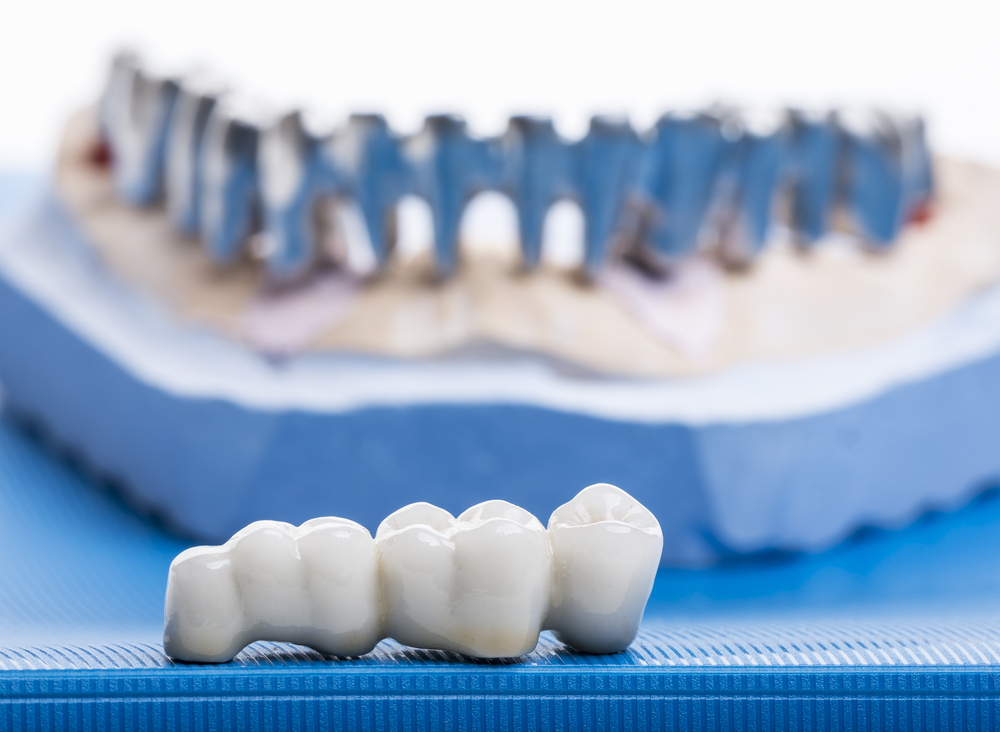 tips to maintain the health of dental crown